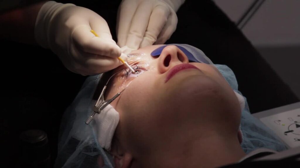 The 5 Must-Do Tips To Aid Quick Recovery After A LASIK Procedure