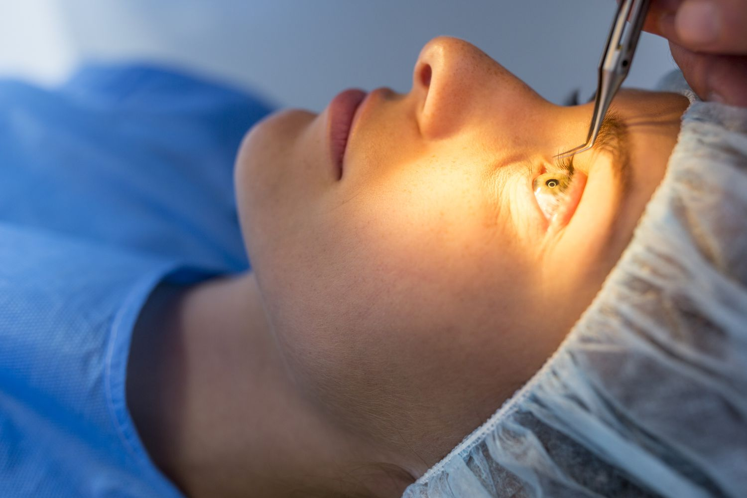 laser eye surgery