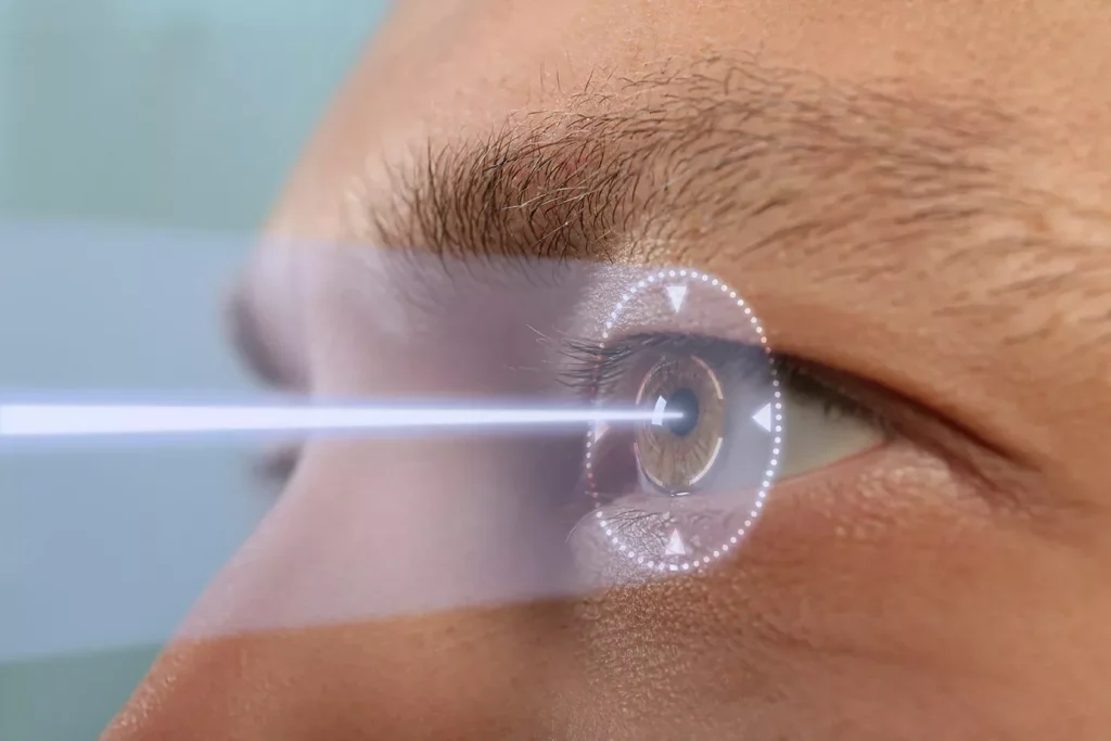 What Are The Main Glaucoma Causes Doctors Look For?